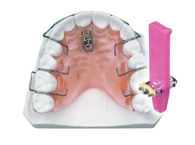 Unilateral Expander Upper Lower BM Ortho Appliances Inc.
