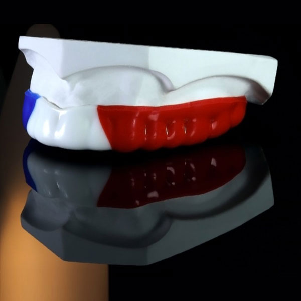 Sport Mouth Guard BM Ortho Appliances Inc.