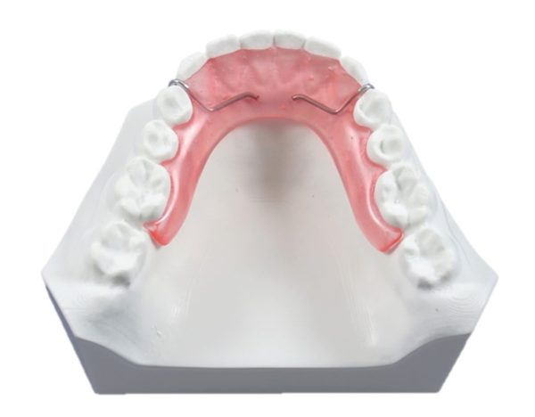 Spring Aligner with Acrylic Extension – BM Ortho Appliances Inc.