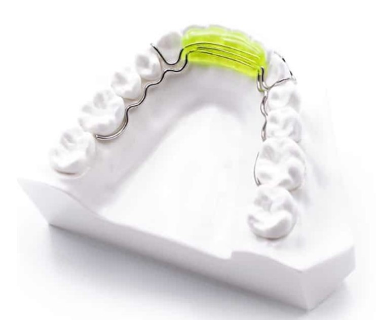 Spring Aligner with wire extension BM Ortho Appliances Inc.